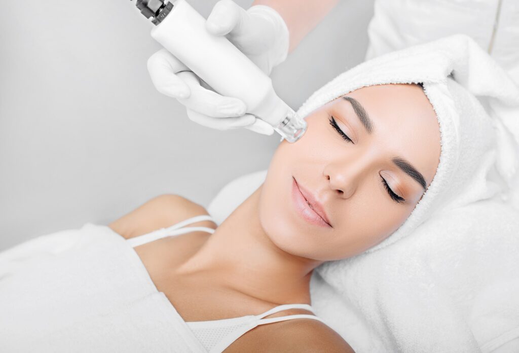 Young Woman Receiving RF Microneedling Treatment | SpaGo MedSpa in Erie, PA