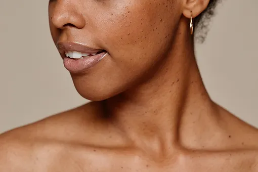 Portrait of young woman sagging skin | SpaGo MedSpa in Erie, PA