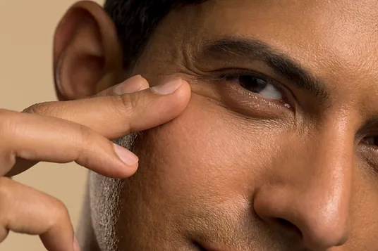 Portrait of a young man checking his under eye bag | SpaGo MedSpa in Erie, PA